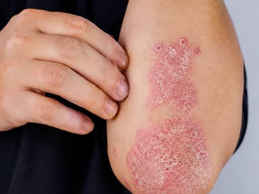NIKAD VIŠE NEĆETE BACITI KORU OD OVE VOĆKE: Liječi psorijazu, skida bradavice i izbjeljuje zube