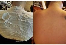 Izgorela je na suncu, a ovo ju je spasilo za 30 minuta: Svi to imamo u kući, a nije jogurt