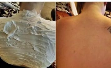 Izgorela je na suncu, a ovo ju je spasilo za 30 minuta: Svi to imamo u kući, a nije jogurt