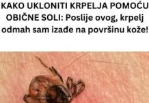 KAKO UKLONITI KRPELJA POMOĆU OBIČNE SOLI: Poslije ovog, krpelj odmah sam izađe na površinu kože!