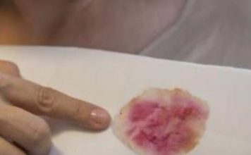NIKADA SE NE BI SJETILI: Sve fleke sa odjeće skida 1 sredstvo, a svi ga imamo u kući