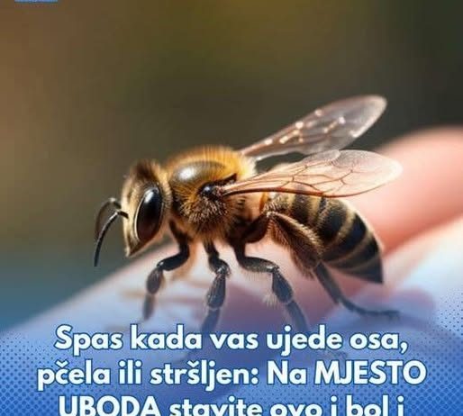 Spas kada vas ujede osa, pčela ili stršljen: Na MJESTO UBODA stavite ovo i bol i otok nestaju