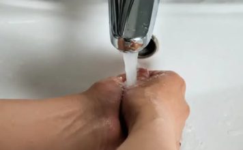 PROVJERITE DA LI IMATE VISOK HOLESTEROL: Stavite ruke pod vodu i uradite ovo