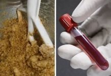 BOMBA ZA KRVNU SLIKU: Tri kašike dnevno, napravite ovu smjesu sami kod kuće