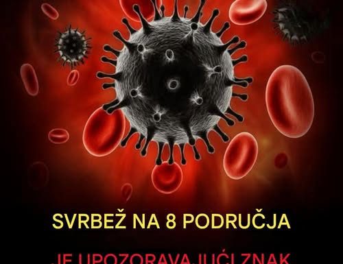 „Šta uzrokuje svrab na različitim dijelovima tijela: kada je bezopasan, a kada potražiti savjet ljekara“