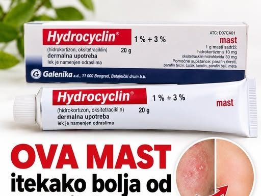 Ova MAST je itekako bolja od mnogih krema, a cijena joj je prava sitnica