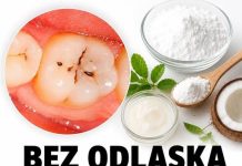 BEZ ODLASKA ZUBARU: Četkajte zube ovom smjesom i recite zbogom kamencu i karijesu zauvijek!