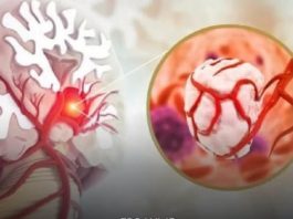 3 simptoma raka koji se javljaju ujutru: Upozoravaju na metastaze, a evo šta odmah treba uraditi