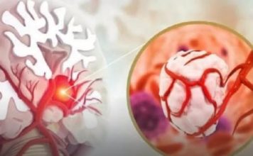 3 simptoma raka koji se javljaju ujutru: Upozoravaju na metastaze, a evo šta odmah treba uraditi