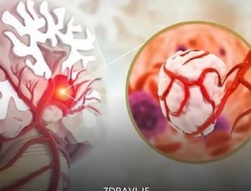 3 simptoma raka koji se javljaju ujutru: Upozoravaju na metastaze, a evo šta odmah treba uraditi