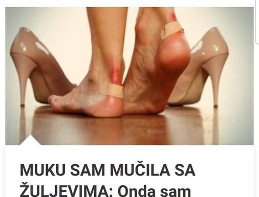 MUKU SAM MUČILA SA ŽULJEVIMA: Onda Sam Otkrila OVAJ Najlukaviji Trik Za Zdrava Stopla U Koje Se Kunu Svi Najveći Modeli Na Svijetu