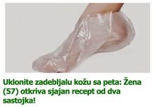 Uklonite zadebljalu kožu sa peta: Žena (57) otkriva sjajan recept od dva sastojka!