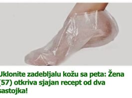 Uklonite zadebljalu kožu sa peta: Žena (57) otkriva sjajan recept od dva sastojka!