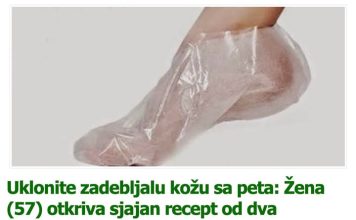 Uklonite zadebljalu kožu sa peta: Žena (57) otkriva sjajan recept od dva sastojka!