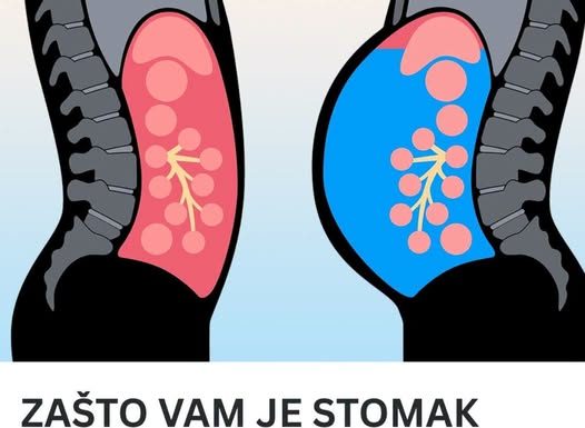 ZAŠTO VAM JE STOMAK STALNO NADUT: Evo koji je uzrok i kako riješiti problem