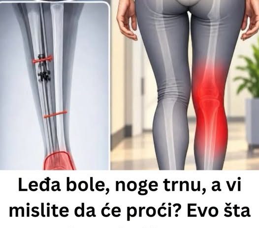Leđa bole, noge trnu, a vi mislite da će proći? Evo šta može stajati iza toga